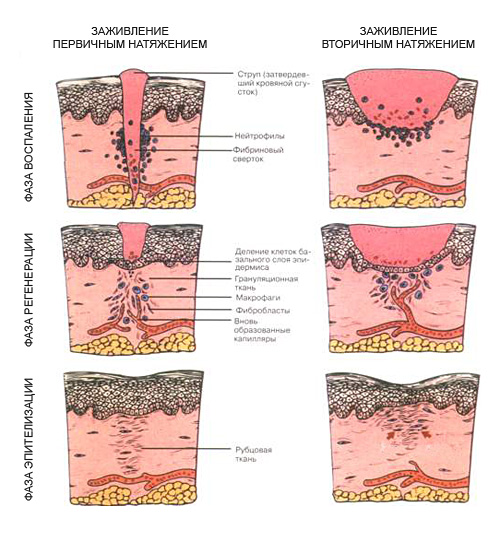 фазы раны.jpg